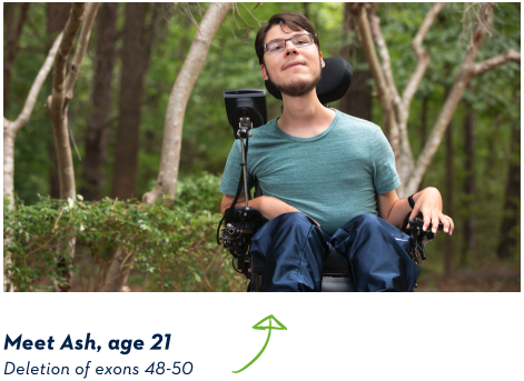 Meet Ash, age 21, deletion of exons 48-50