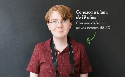Conozca a Liam, 19 años. Deleción de exones 48-50.