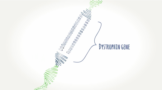 EXONDYS 51 understanding exon skipping dystrophin gene EXONDYS 51 illustration depicting dystrophin gene and exons as part of understanding exon skipping technology