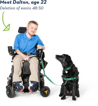 EXONDYS 51 patient Dalton and his dog EXONDYS 51 patient Dalton, age 22, seated in wheelchair with his black service dog sitting by his side looking up at him